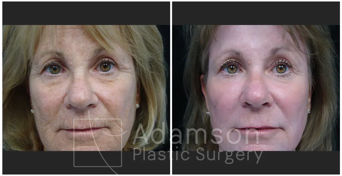 Treatment of The Skin JM